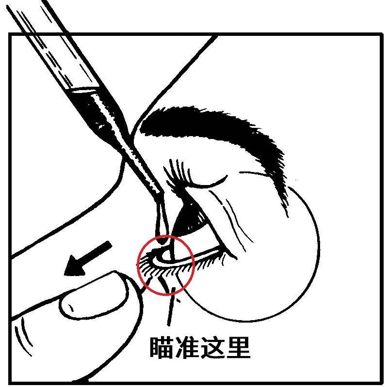 涂于眼下睑穹窿部图图片