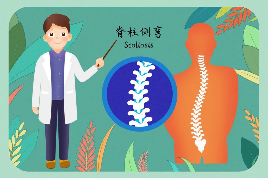 别让脊柱侧弯“偷走”孩子挺拔的身姿|科普时间